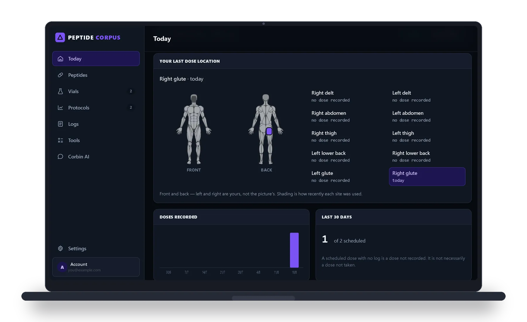 The app open on the Today screen, showing front and back body diagrams with the most recent injection site marked, and a list of ten sites with when each was last used.
