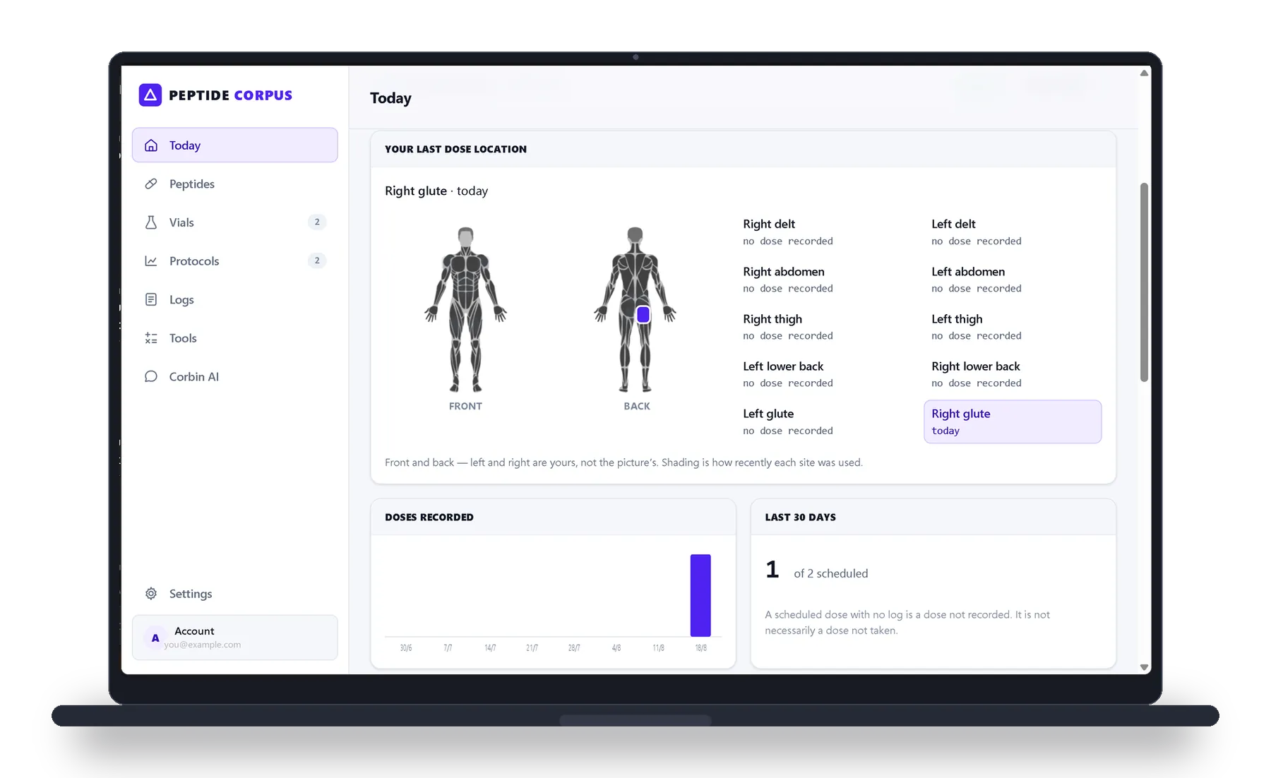 The app open on the Today screen, showing front and back body diagrams with the most recent injection site marked, and a list of ten sites with when each was last used.